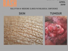 "A PRIVATE RASH" - KOM CPC BY DEPT. OF SURGERY